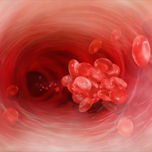 Symptoms Of Hemroids Hemroids - Bleeding Hemorrhoid - A Cure For Hemorrhoids - External Hemorrhoid Surgery